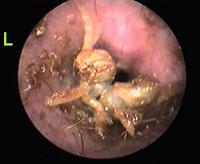 case study ear ticks
